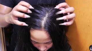 Fast amp Aggressive ASMR Scratch Itchy Scalp So I Did Satisfying Scalp Scratching  No Talking [upl. by Sopher]