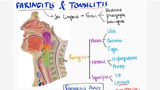 Faringitis  Radang Tenggirokan  Klasifikasi Etiologi Diagnosis Tatalaksana [upl. by Pickering]