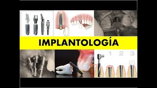 quotIMPLANTOLOGÍA INTEGRADAquot [upl. by Naej]