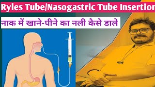 ryles tube insertion nasogastric tube insertion hindi technique NG Tube RT Insertion Dr Satish [upl. by Yerffoeg161]