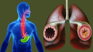 Coughing At Night Causes And Home Remedies [upl. by Saoj851]