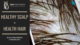 HEALTHY SCALP  HEALTHY HAIR  TRICHOLOGY [upl. by Schellens]