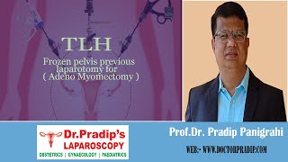 TLHFrozen Pelvis Previous Laparotomy forAdeno Myomectomylaparoscopicsurgeon video doctor [upl. by Asirahc959]