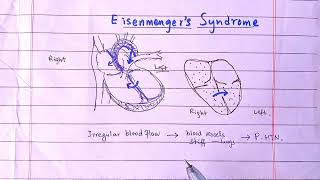 Eisenmenger syndrome  What will Happen If Blood Flows From Right to Left Heart [upl. by Petracca806]