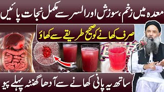 Gastric Ulcer Treatment  Peptic Ulcer Ka Treatment  Ulcer Ka ilaj in Urdu Dr Sharafat Ali Videos [upl. by Suillenroc]