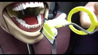 Posterior Periapical Mandibular Placement [upl. by Kim]