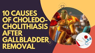 10 Causes Of Choledocholithiasis After Gallbladder Removal [upl. by Akenal712]