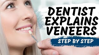 Porcelain Veneers Procedure Explained [upl. by Verena727]