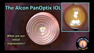 What Are My Lens Options for Cataract Surgery [upl. by Cousins]