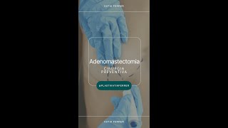 Entenda mais sobre a Adenomastectomia [upl. by Eads846]