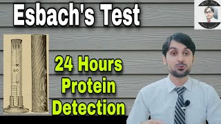 Esbachs Test  Practical  Quantitative Estimation of Albumin in Urine [upl. by Aleemaj]