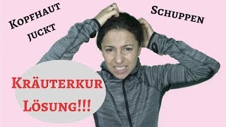 Kopfhaut juckt gereizt Schuppen  Einfache Lösung [upl. by Sirama]