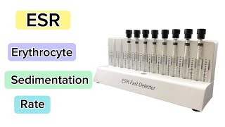 ESR Erythrocyte Sedimentation Rate Procedure laboratory medtechstudent cls mls hematology ESR [upl. by Rupert]