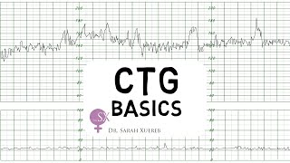 CTG Basics [upl. by Bartholomeus762]