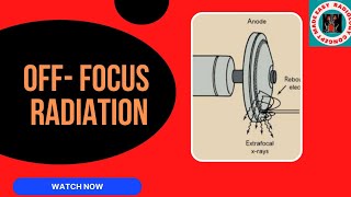 OFF FOCUS RADIATION radiation xray anode cathode  x ray tube [upl. by Ethelinda]