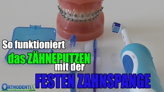 ZÄHNEPUTZEN mit der FESTEN ZAHNSPANGE  Orthodentix [upl. by Ebner]