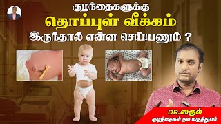 குழந்தைகளுக்கு தொப்புள் வீக்கம் இருந்தால் என்ன செய்யணும்   Dr Saguls Paediatric corner [upl. by Notnert323]