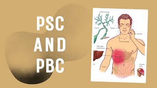 Primary sclerosing cholangitis PSC and Primary biliary cirrhosis PBC neetpg usmle fmge [upl. by Arnaud98]