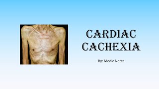 Cardiac cachexia  definition causes pathophysiology sign value [upl. by Felic757]