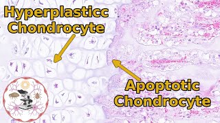 Epiphyseal Growth Plate Histology  Time to Zone Out [upl. by Zetra]