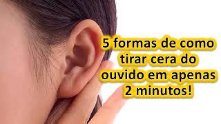 5 formas de como tirar cera do ouvido em apenas 2 minutos [upl. by Gyasi]