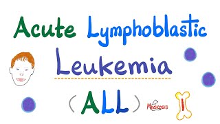 Acute Lymphoblastic Leukemia ALL  Symptoms Pathogenesis Diagnosis  Down Syndrome  Hematology [upl. by Whit]