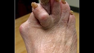 Ugly Feet  Watch if you dare [upl. by Wolcott]