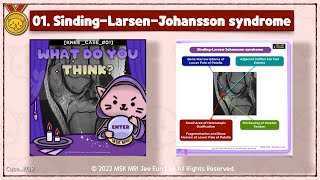 Knee01 SindingLarsenJohansson syndrome [upl. by Anaitsirhc]