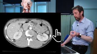 Abdomen transverse CT imaging anatomy [upl. by Savell467]