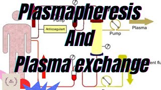 Plasmapheresis part1Plasma exchangeTherapeutic plasma exchangetherapeutic plasmapheresisTPEPE [upl. by Rufe]