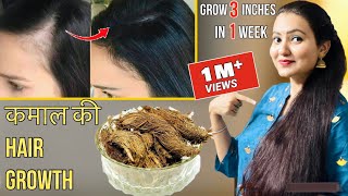 30 Days Extreme Hair Growth Challenge  कितने भी झड़ चुके हों बाल इस रेमेडी से होगी कमाल की Growth [upl. by Odeen]