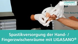 Spastikversorgung der Hand und Fingerzwischenräume mit LIGASANO® [upl. by Eniksre]