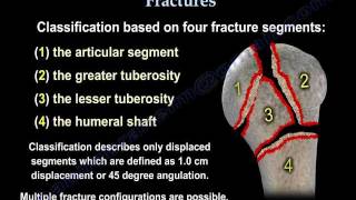 Proximal Humerus Fractures classification  Everything You Need To Know  Dr Nabil Ebraheim [upl. by Ahsercul]