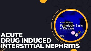 Acute drug induced interstitial nephritis  Causes Pathogenesis  Morphology  Clinical features [upl. by Llebyram298]