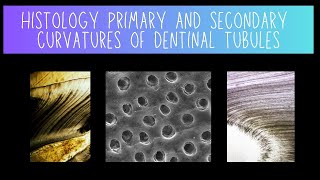 Histology of Primary and Secondary Dentinal Tubule Curvatures  Dentistry [upl. by Bortman]