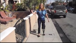 Walking With a Torn Calf Muscle  Kristi Walks on the iWALK20 for the First Time [upl. by Conlin]