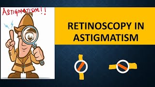 RETINOSCOPY in ASTIGMATISM  Break intensity  brightness and skew  Straddling [upl. by Atnoed]