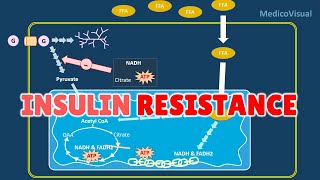 Insulin Resistance Part 2 Basal Lipolysis Free Fatty Acids and Randle cycle Hypothesis [upl. by Alessandra]