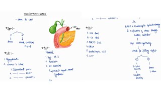 CHOLEDOCHOLITHIASIS NOTES ONE PAGE NOTES  GALL BLADDER  SURGERY  4TH PROFF  MBBS [upl. by Jeanelle66]