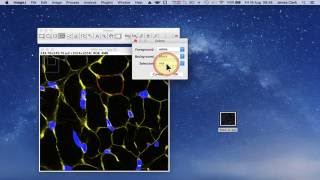 Using ImageJ to measure cell number and crosssectional area of confocal images [upl. by Ahtamat785]