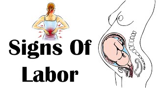 Signs Of Labor  Stages amp Signs Of Labor What Are The Early amp Late Signs Of labor [upl. by Dolorita]