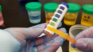 Introduction to Clinical Lab pH Paper Measurement [upl. by Lehcsreh823]