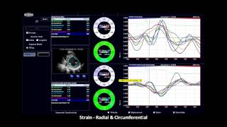 E CUBE  Cardiac Ultrasound System [upl. by Geneva88]