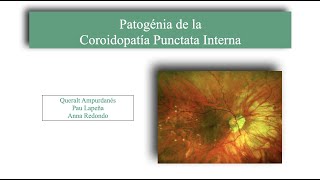 Patogénia de la Coroidopatía Punctata Interna [upl. by Anerat]