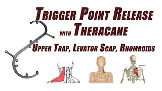 Trigger Point Release in the Upper Trapezius Levator Scapulae and Rhomboids Using a Cane Device [upl. by Merrily]