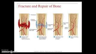 Skeletal system diseases and disorders [upl. by Dionysus805]