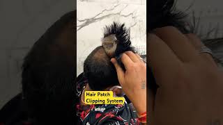 Hair Patch Clip System  Hair Patch Clipping System for Men in Delhi 9643760504 [upl. by Llenroc]