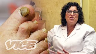 Meet a Toenail Fungus Expert [upl. by Merrielle392]