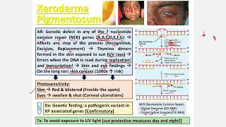 Xeroderma Pigmentosa CBL [upl. by Dame]