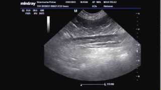 TROMBOSIS AORTA ABDOMINAL POR HIPER ADRENOCORTICISMO TAF [upl. by Peters]